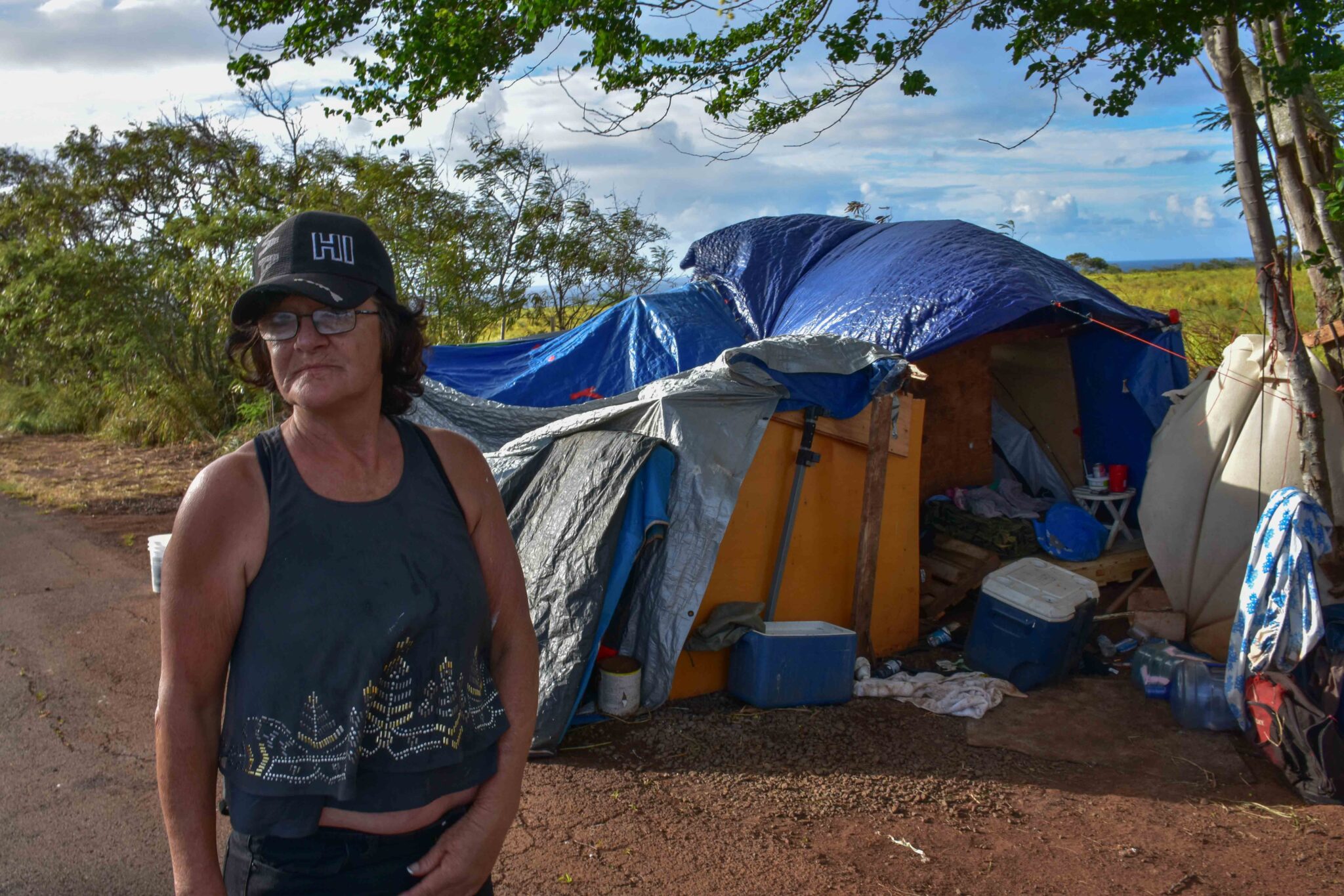 Tracy Shaffer, 60, who lives along Holomua Road in Paia has been homeless for about two years since she was in a moped accident that has left her memory fuzzy and her head with a big scar. (Cammy Clark/Civil Beat/2024)