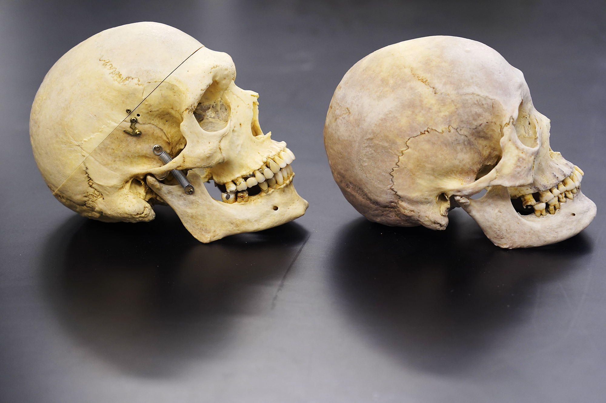 How A Human Bone Collection in Honolulu Aids Forensic Anthropology in ...