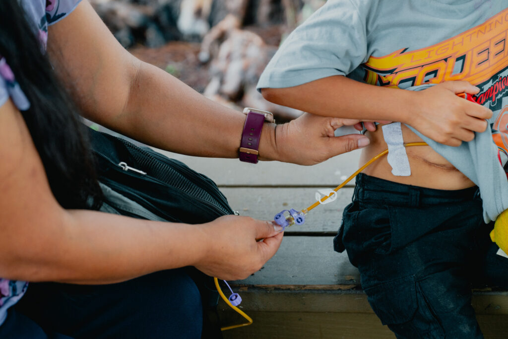 Closeup of Leilani Kaliawa fixing the tubing of her son Jeremiah's feeding tube.